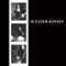 Sleater Kinney | LP